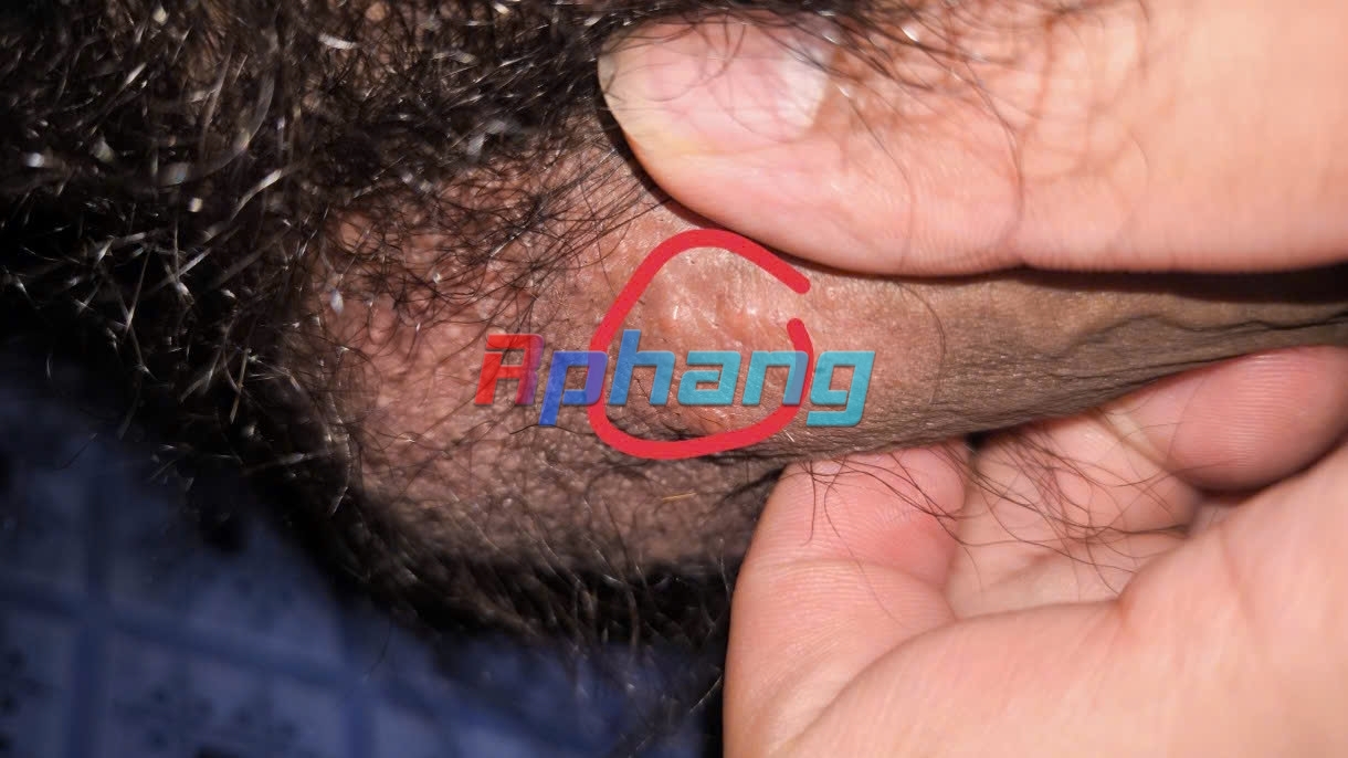 1000006279.jpg